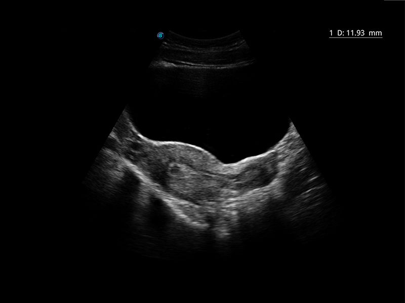 ultrasound Sonoscape E2