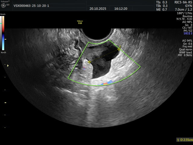 איכות הדמיה
