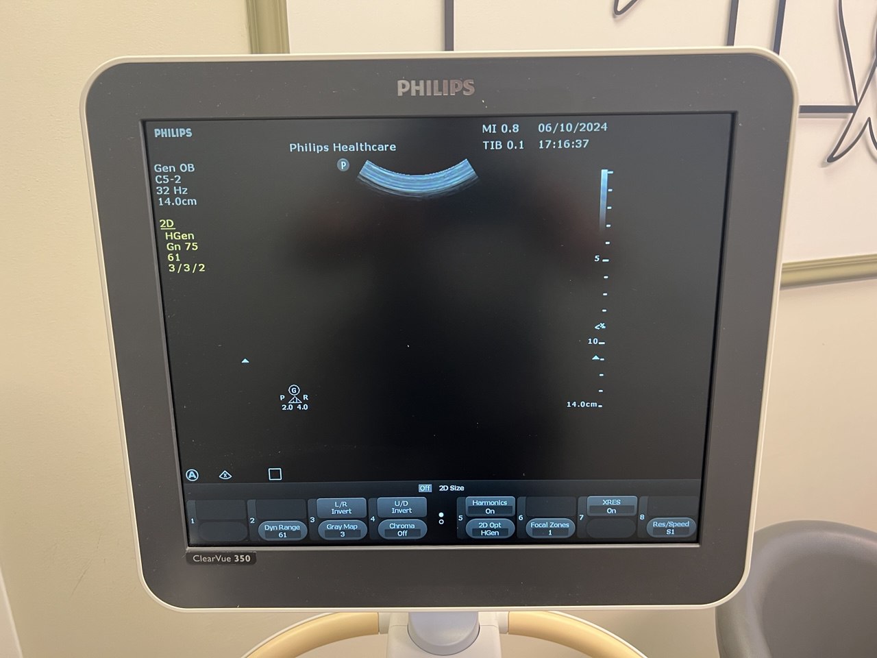 PHILIPS CLEARVUE 350 מכשיר אולטרסאונד