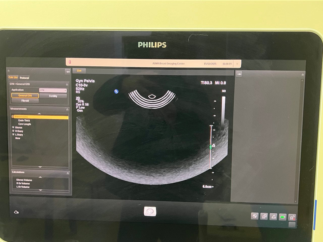 Probe Philips C10-3V by Ultrasound Probes & Transducers