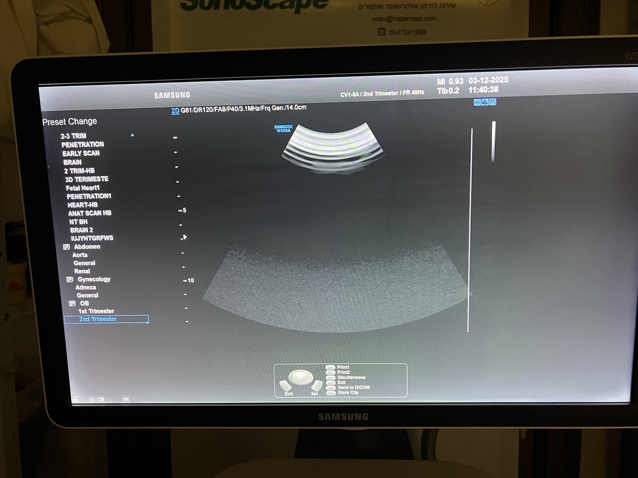 מחודשים מתמרים למכירה