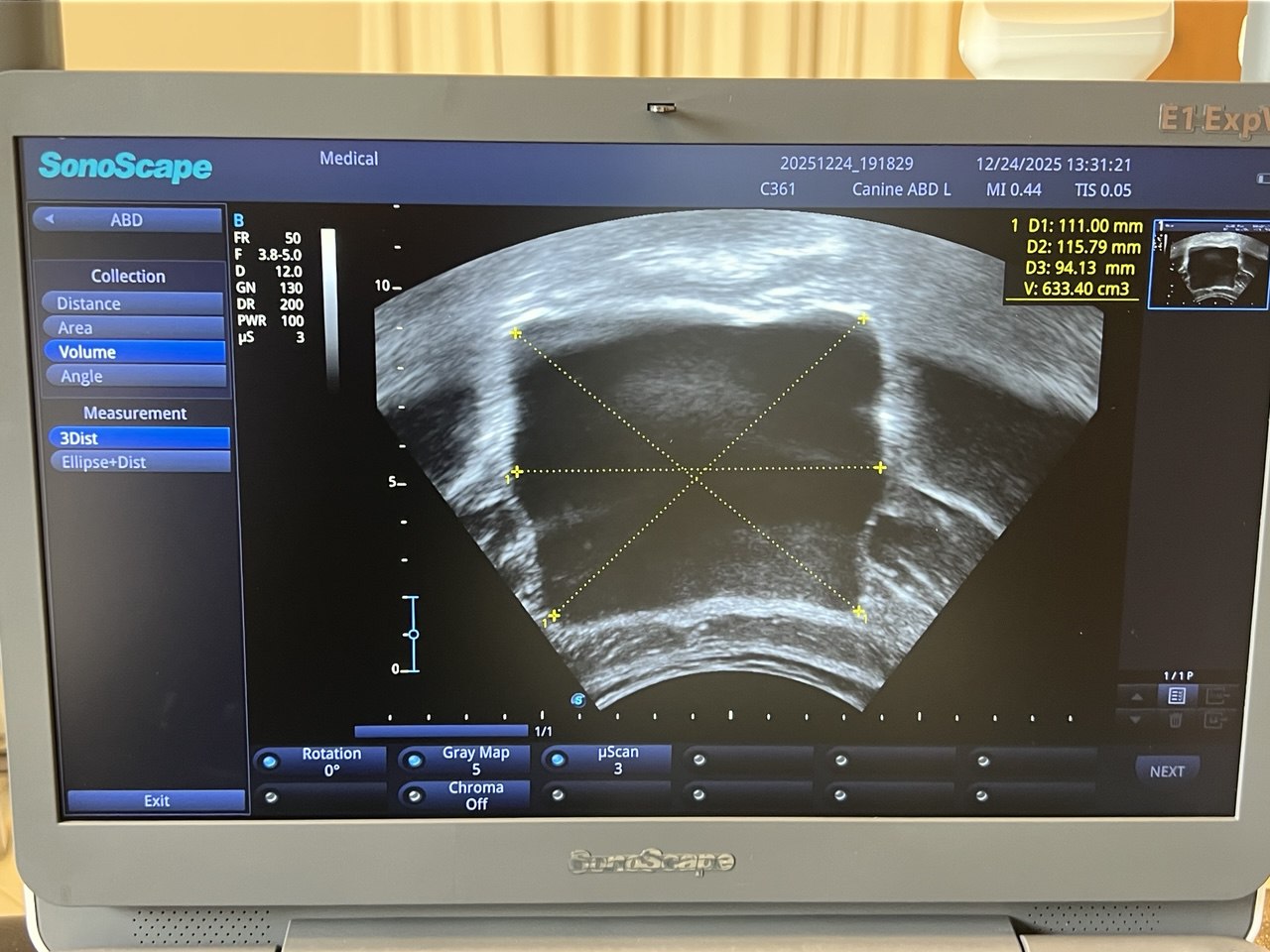 מכשיר אולטרסאונד יזיוטרפיסט