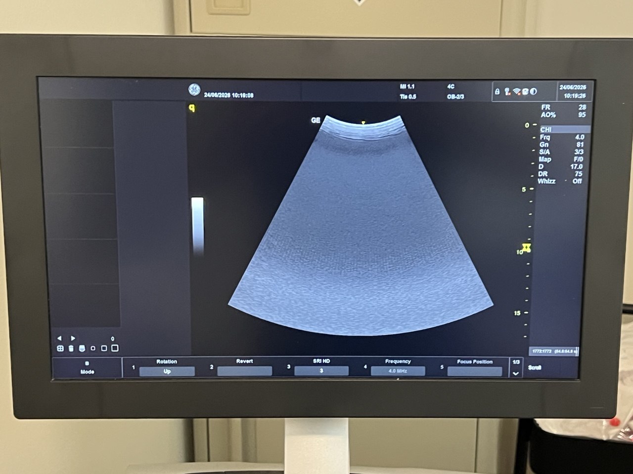 Ultrasound GE Versana Essential by Ultrasound Probes & Transducers