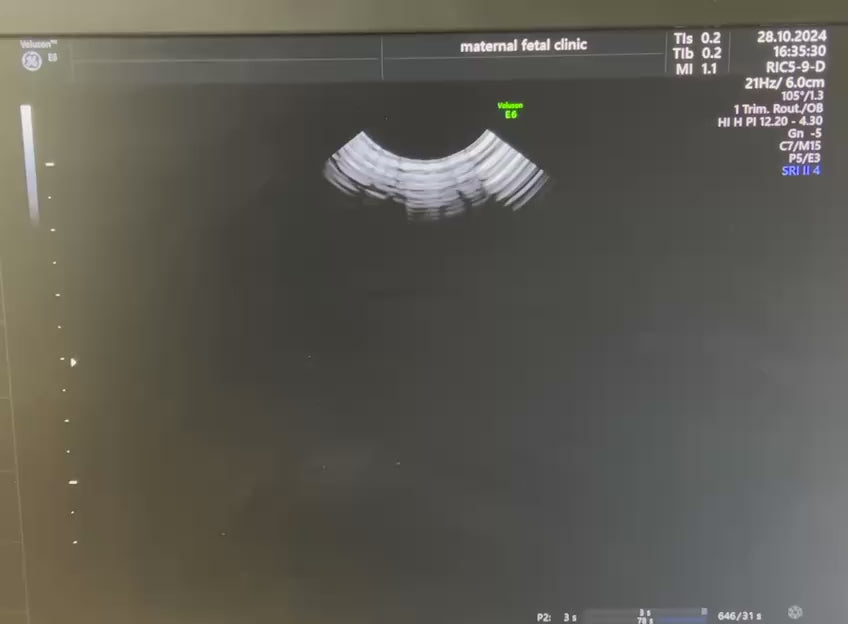 חוסר שמן במתמר וגינלי תלת מימד 3D