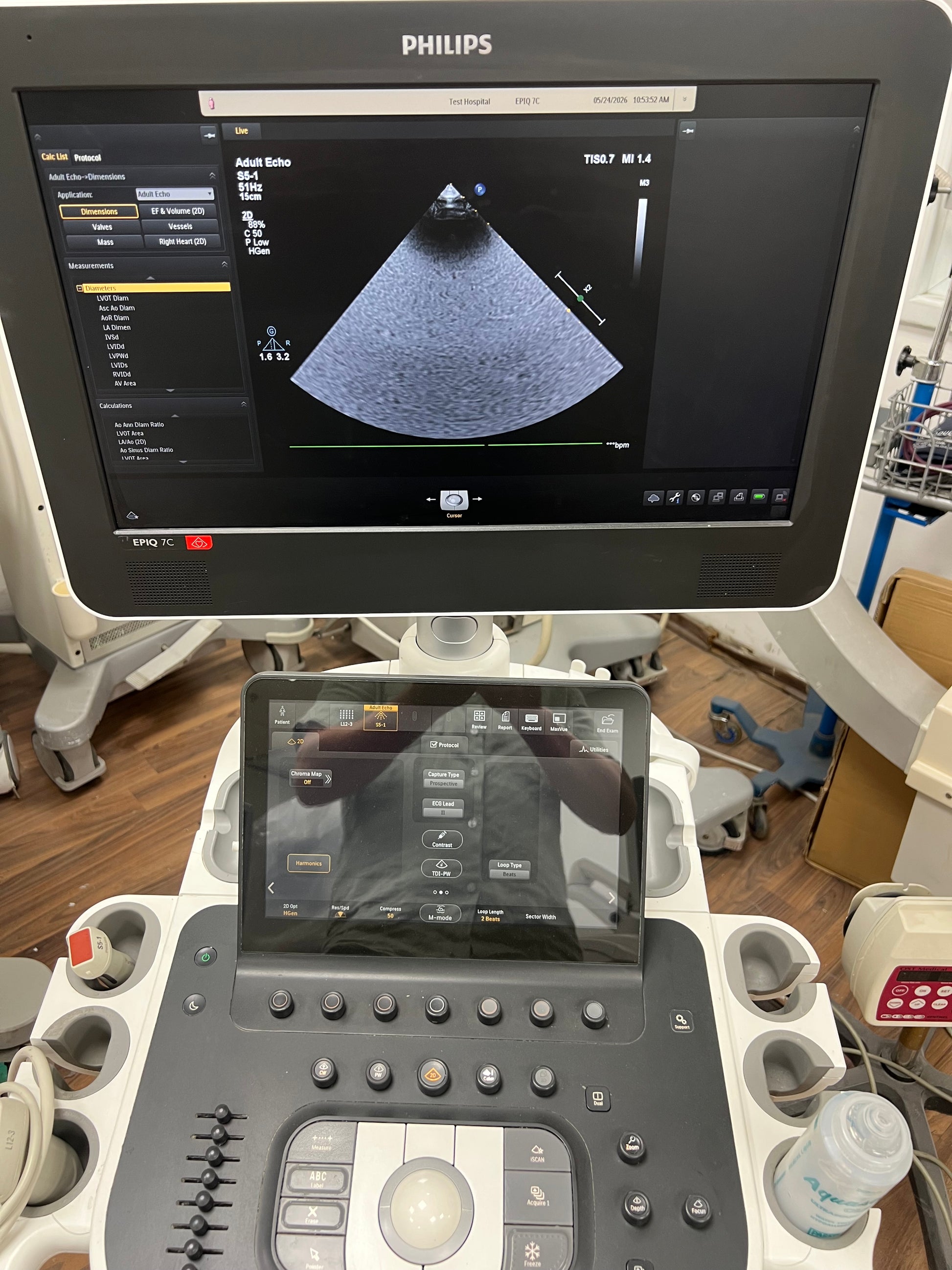 Philips EPIQ 7C ultrasound by Ultrasound Probes & Transducers