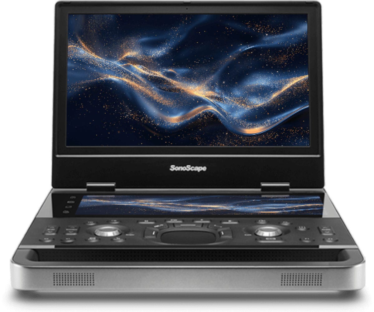E10i Advanced Portable Ultrasound System by Ultrasound Probes & Transducers