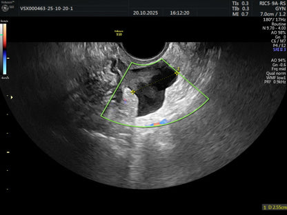 איכות הדמיה
