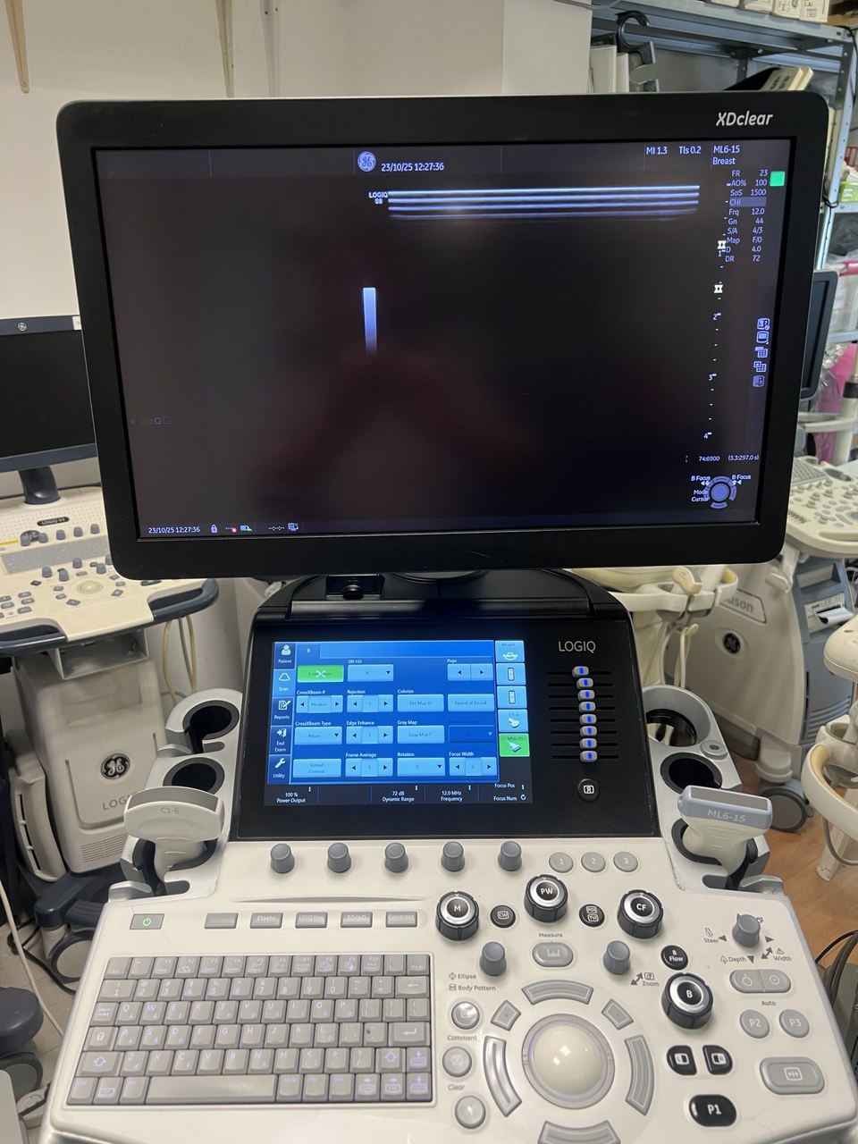 מכשיר אולטראסונד לרדיולוגיה