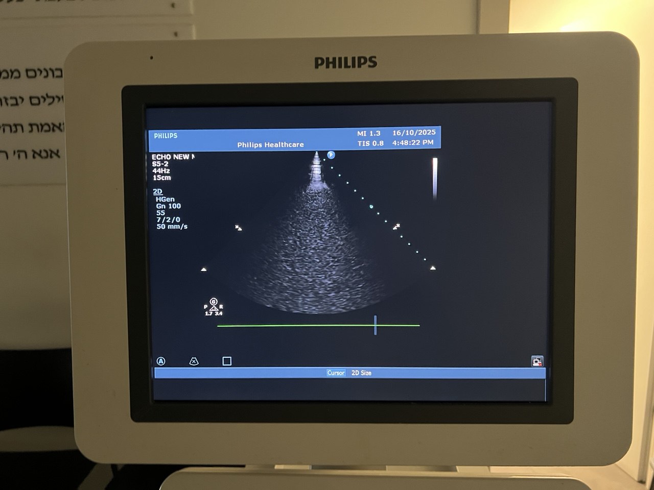 מכשיר  אולטרסאונד קרדיו