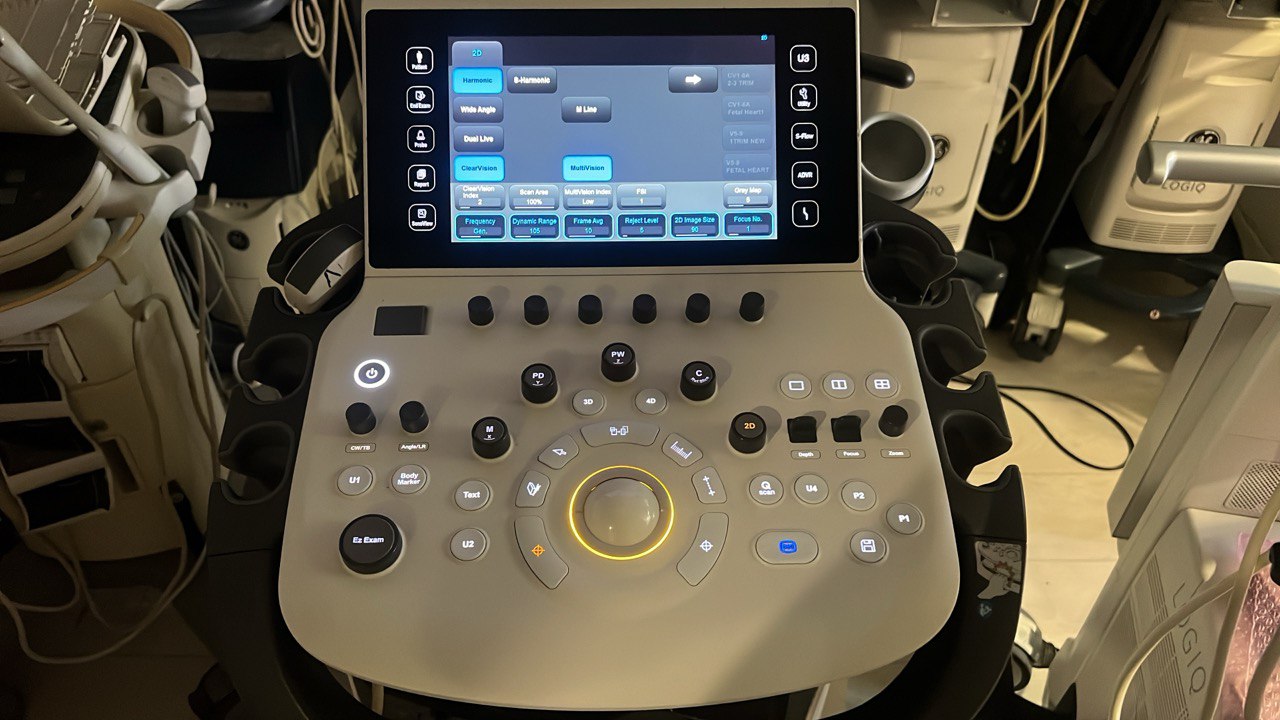 מכשיר US יד 2