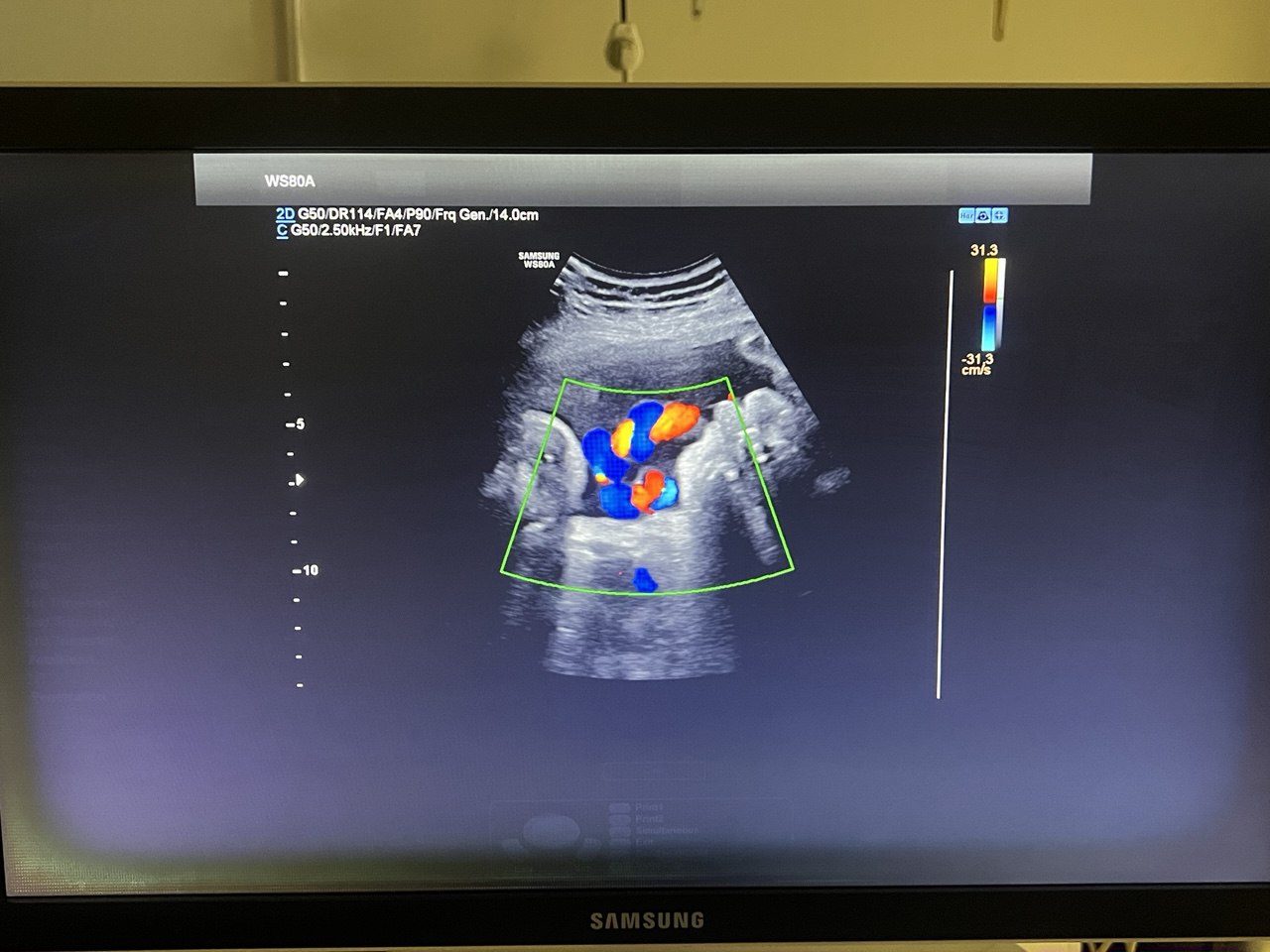 מכשיר אולטרסאונד יד 2