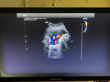 מכשיר אולטרסאונד יד 2