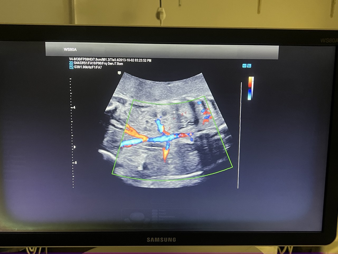 מכשיר אולטראסאונד לגניקולוגיה