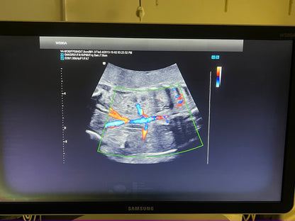 מכשיר אולטראסאונד לגניקולוגיה