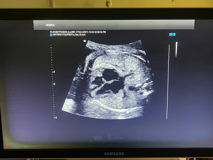 מכשיר אולטרסאונד משומש