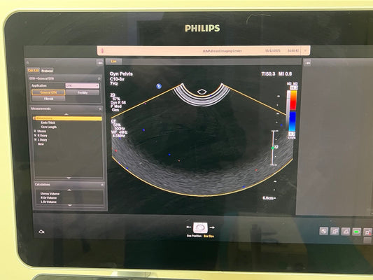 איכות הדמייה מתמר 