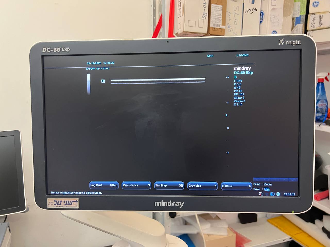 Ultrasound Mindray Used