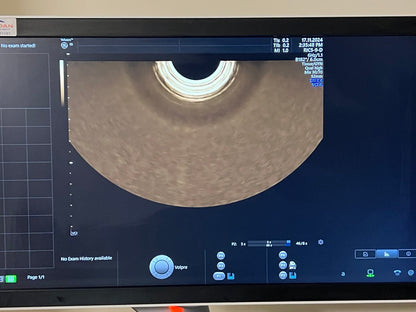 מצב של מתמר אולטרסאונד