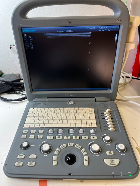 Ultrasound Sonoscape S2