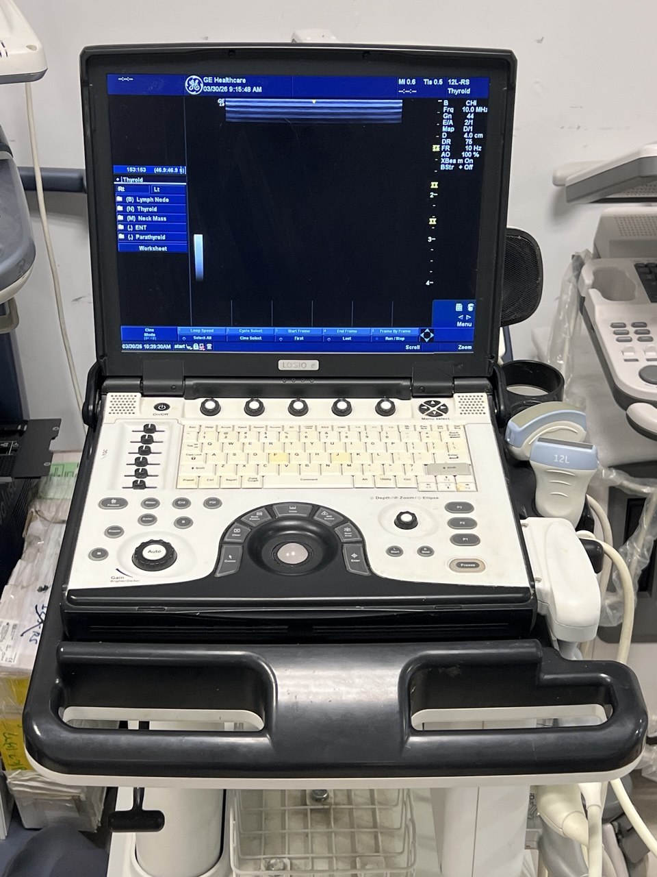 mobile ultrasound system GE,