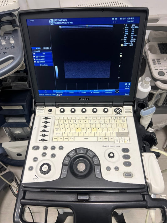 laptop ultrasound system