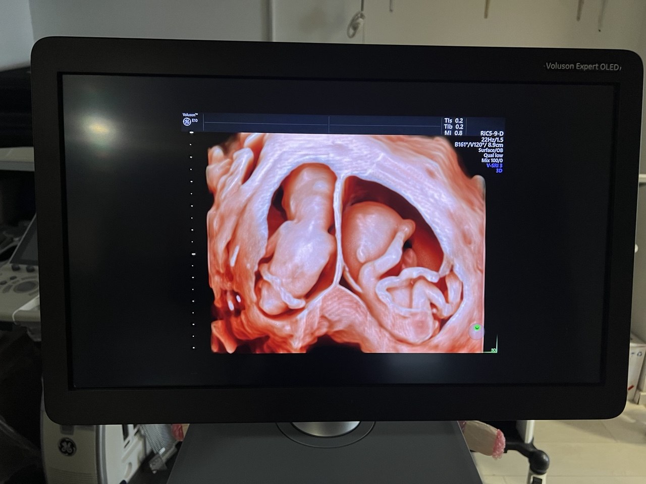 GE 4D ultrasound machine