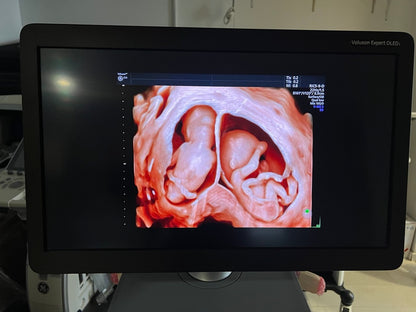 GE 4D ultrasound machine