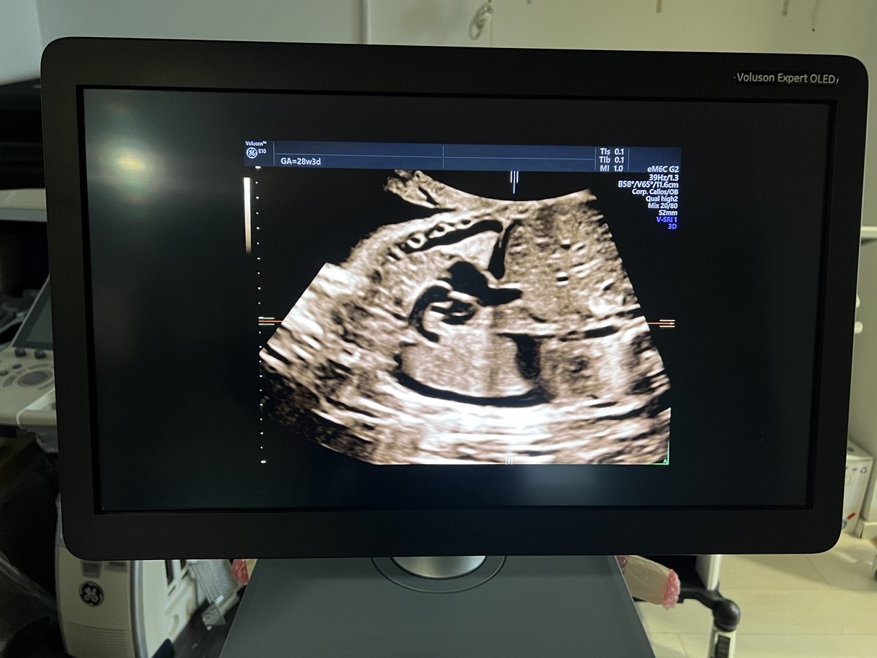  high-end fetal imaging ultrasound