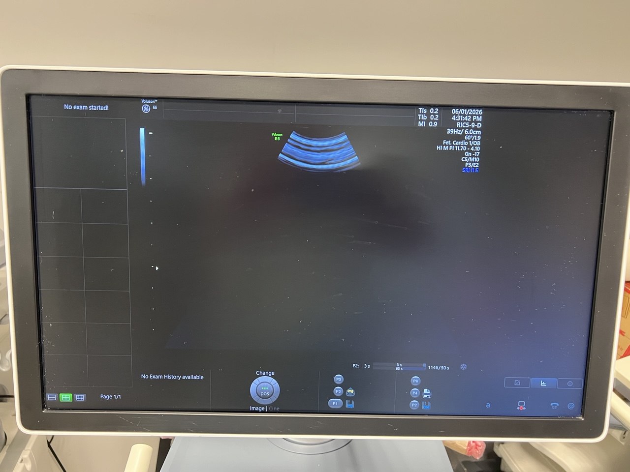 Ultrasound Voluson E6 BT20 by Ultrasound Probes & Transducers
