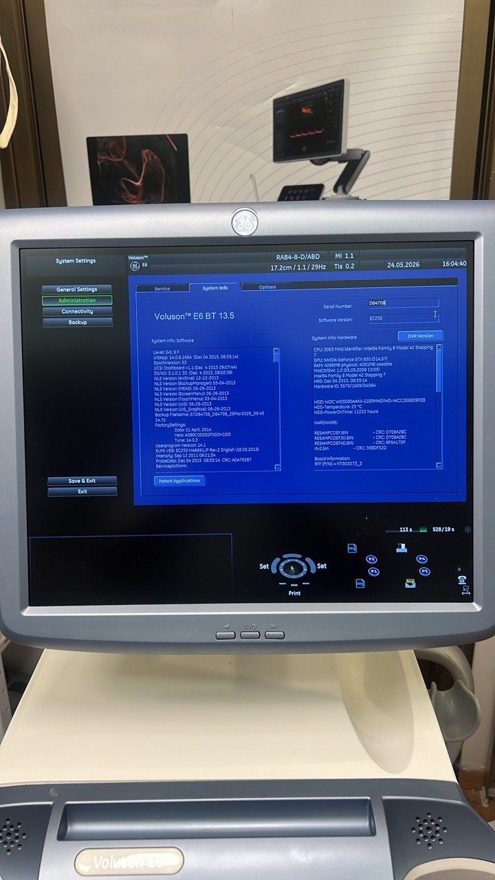 Ultrasound GE Voluson E6 BT 13,5 (2016) by Ultrasound Probes & Transducers