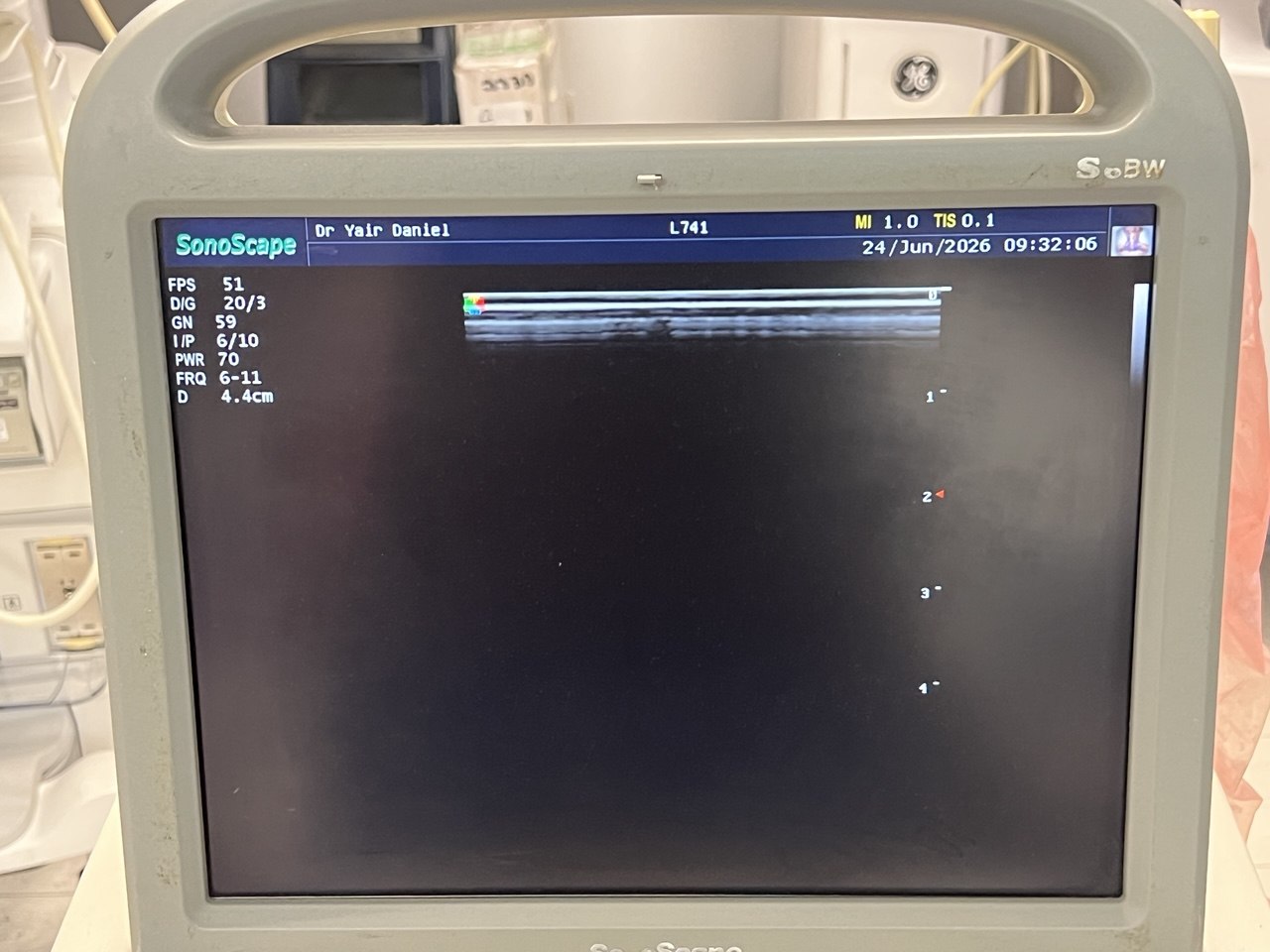 Utrasound Sonoscape S6 by Ultrasound Probes & Transducers
