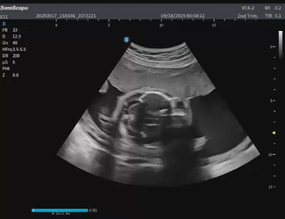 E10i Advanced Portable Ultrasound System