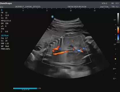 E10i Advanced Portable Ultrasound System