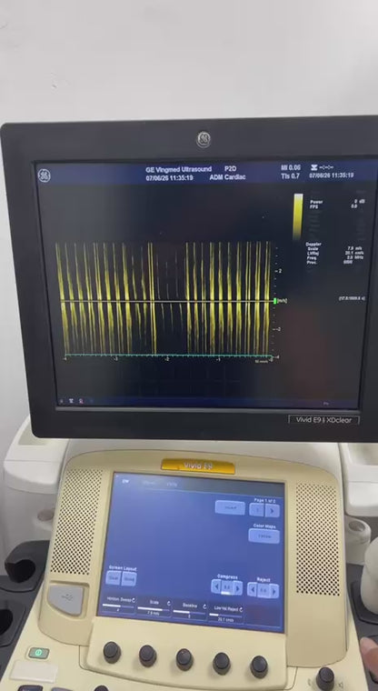 Ultrasound Vivid E9 GE